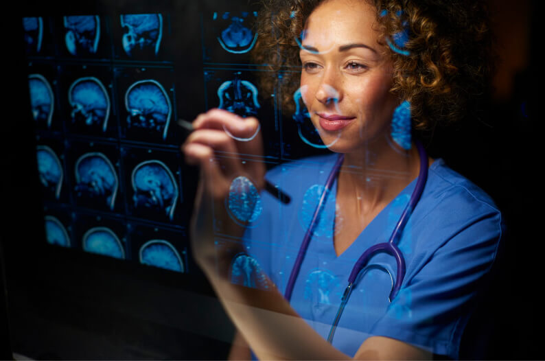 Female doctor looking at CT scans of an epilepsy patient's brain.